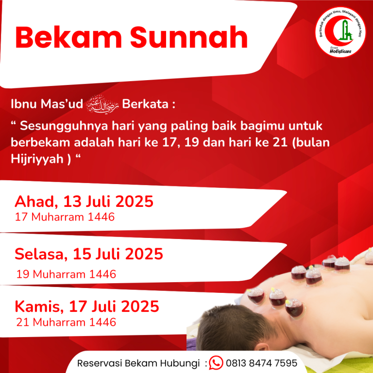 bekam sunnah (1)